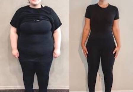 طبيب مصري يبهر العالم باكتشاف جديد يدمر السمنة بدون رجيم أو رياضة