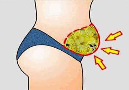 طريقة مثيرة لفقدان الدهون بدون دايت.. (-15) كجم في 14 يوم! طريقة مضمونة 100%